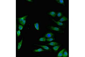 Immunofluorescent analysis of Hela cells using ABIN7150092 at dilution of 1:100 and Alexa Fluor 488-congugated AffiniPure Goat Anti-Rabbit IgG(H+L) (DISC1 抗体  (AA 99-325))