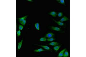 Immunofluorescent analysis of Hela cells using ABIN7150092 at dilution of 1:100 and Alexa Fluor 488-congugated AffiniPure Goat Anti-Rabbit IgG(H+L) (DISC1 抗体  (AA 99-325))