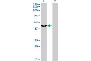Western Blot analysis of MVD expression in transfected 293T cell line by MVD monoclonal antibody (M01), clone 2A7. (MVD 抗体  (AA 301-398))