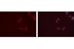 ABIN6277347 staining Hela cells by IF/ICC. (CPT2 抗体  (Internal Region))