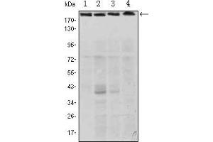 Western blot analysis using RICTOR mouse mAb against Hela (1), PANC-1 (2), MOLT4 (3), and HepG2 (4) cell lysate. (RICTOR 抗体)