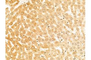 ABIN6258060 and ABIN6274642 at 1/100 staining Rat liver tissue by IHC-P.