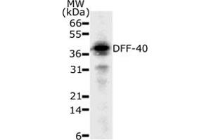 Western Blotting (WB) image for anti-DNA Fragmentation Factor, 40kDa, beta Polypeptide (Caspase-Activated DNase) (DFFB) (AA 205-222) antibody (ABIN208001)