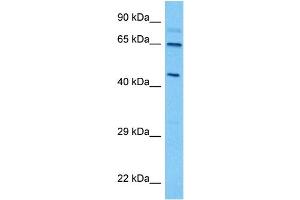 Host:  Mouse  Target Name:  THRA  Sample Tissue:  Mouse Spleen  Antibody Dilution:  1ug/ml (THRA 抗体  (Middle Region))