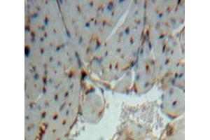 Used in DAB staining on fromalin fixed paraffin-embedded Heart tissue (NOSTRIN 抗体  (AA 6-245))