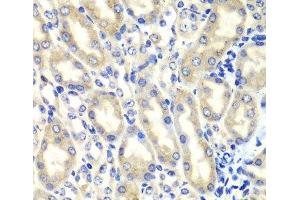 Immunohistochemistry (Paraffin-embedded Sections) (IHC (p)) image for anti-Prostaglandin E Synthase 2 (PTGES2) antibody (ABIN7011601)