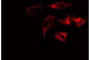 ABIN6275217 staining  Hela cells by IF/ICC. (Macrophage Mannose Receptor 1 抗体  (Internal Region))
