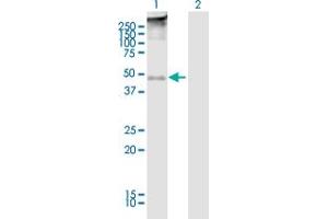 Western Blotting (WB) image for anti-Transmembrane Protein with EGF-Like and Two Follistatin-Like Domains 2 (TMEFF2) (AA 1-374) antibody (ABIN2752464)