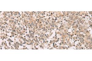 Immunohistochemistry of paraffin-embedded Human tonsil tissue using M1AP Polyclonal Antibody at dilution of 1:80(x200) (Meiosis 1 Associated Protein (M1AP) 抗体)