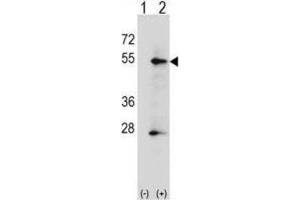 Western Blotting (WB) image for anti-Placental Alkaline Phosphatase (ALPP) antibody (ABIN2998362) (PLAP 抗体)