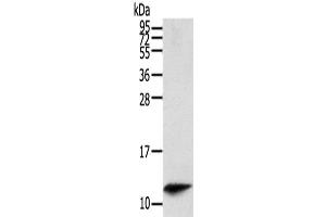 Western Blot analysis of Mouse spleen tissue using PBOV1 Polyclonal Antibody at dilution of 1/200 (PBOV1 抗体)