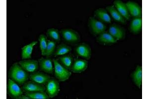 Immunofluorescent analysis of A549 cells using ABIN7175353 at dilution of 1:100 and Alexa Fluor 488-congugated AffiniPure Goat Anti-Rabbit IgG(H+L) (VPS39 抗体  (AA 263-490))