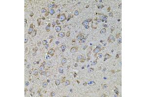 Immunohistochemistry of paraffin-embedded mouse brain using CPOX antibody. (CPOX 抗体  (AA 111-454))