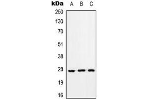 Western blot analysis of RAB33A expression in HEK293T (A), Raw264. (RAB33A 抗体  (Center))