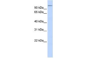 Western Blotting (WB) image for anti-Thioredoxin Domain Containing 16 (TXNDC16) antibody (ABIN2459303) (TXNDC16 抗体)