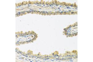 Immunohistochemistry of paraffin-embedded human prostate using CRHBP antibody (ABIN5973945) at dilution of 1/100 (40x lens). (CRHBP 抗体)