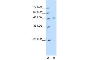 WB Suggested Anti-KRT20  Antibody Titration: 1. (KRT20 抗体  (Middle Region))