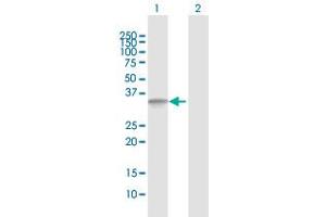 Western Blot analysis of ANKRA2 expression in transfected 293T cell line by ANKRA2 MaxPab polyclonal antibody. (ANKRA2 抗体  (AA 1-313))