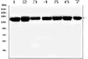 Western blot analysis of SMARCAD1 using anti-SMARCAD1 antibody (ABIN6719539).