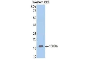 Detection of Recombinant ENG, Mouse using Polyclonal Antibody to Endoglin (ENG) (Endoglin 抗体  (AA 336-450))