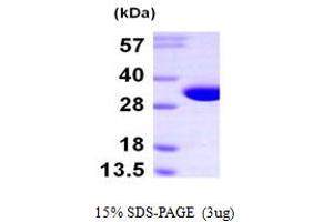 SDS-PAGE (SDS) image for Nitrilase Family, Member 2 (NIT2) (AA 1-276) protein (His tag) (ABIN667846) (NIT2 Protein (AA 1-276) (His tag))