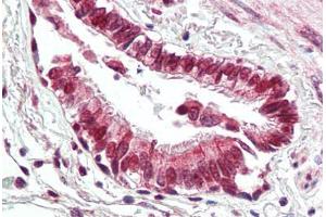Human Lung, Respiratory Epithelium (formalin-fixed, paraffin-embedded) stained with BECN1 antibody ABIN461894 at 2. (Beclin 1 抗体  (C-Term))