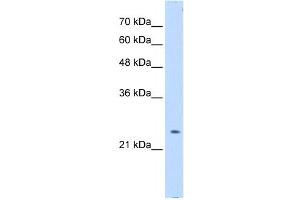 PTPN2 antibody used at 0. (PTPN2 抗体  (Middle Region))
