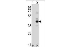 Western blot analysis of PRKACB (arrow) using rabbit polyclonal PRKACB Antibody (K29) (ABIN6243845 and ABIN6578978). (PRKACB 抗体  (N-Term))
