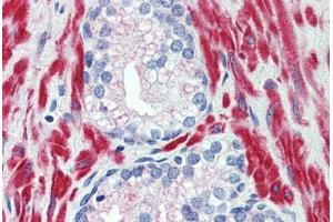 Immunohistochemistry (IHC) image for anti-Transient Receptor Potential Cation Channel, Subfamily M, Member 8 (TRPM8) (N-Term) antibody (ABIN960829)