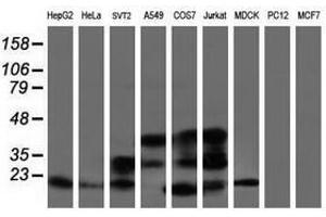 Image no. 4 for anti-ADP-Ribosylation Factor-Like 2 Binding Protein (ARL2BP) antibody (ABIN1496716)