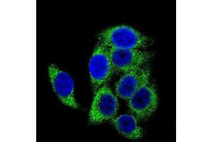 Immunofluorescence (IF) image for anti-Tuberous Sclerosis 2 (TSC2) (pSer1387) antibody (ABIN3001803)