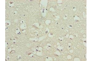 Immunohistochemistry of paraffin-embedded human brain tissue using ABIN7172953 at dilution of 1:100 (TMCC1 抗体  (AA 51-300))