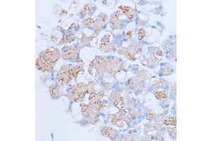 Immunohistochemistry of paraffin-embedded rat pancreas using NME6 antibody (ABIN7268942) at dilution of 1:100 (40x lens). (NME6 抗体  (AA 9-194))