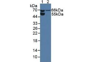 Western blot analysis of (1) Rat Serum and (2) Rat Kidney Tissue. (Endoglin 抗体  (AA 26-136))