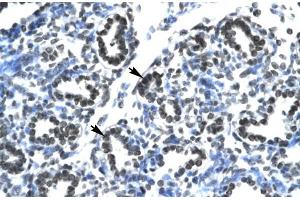 Human Lung; CLDN17 antibody - middle region in Human Lung cells using Immunohistochemistry (Claudin 17 抗体  (Middle Region))