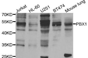 Western blot analysis of extracts of various cell lines, using PBX1 antibody. (Prolactin 抗体)