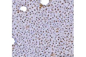 IHC analysis of HNRNPL using anti-HNRNPL antibody (ABIN4886624).