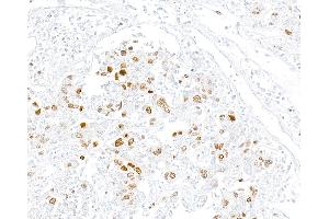 Immunohistochemistry (IHC) image for anti-Topo IIalpha (AA 650-700) antibody (ABIN7795794) (Recombinant Topo IIalpha (AA 650-700) 抗体)