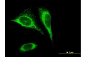 Immunofluorescence of purified MaxPab antibody to SLC25A24 on HeLa cell. (SLC25A24 抗体  (AA 1-477))