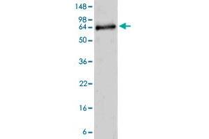Image no. 1 for ADAM Metallopeptidase with Thrombospondin Type 1 Motif, 10 (ADAMTS10) (AA 214-672) protein (ABIN5569876) (ADAMTS10 Protein (AA 214-672))