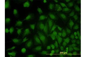 Immunofluorescence (IF) image for anti-Major Vault Protein (MVP) (AA 1-893) antibody (ABIN564285)
