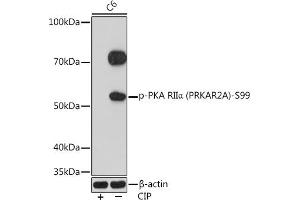 Western blot analysis of extracts of C6 cells, using Phospho-PKA RIIα (PRKA)-S99 Rabbit mAb (ABIN7269661) at 1:1000 dilution. (PRKAR2A 抗体  (pSer99))