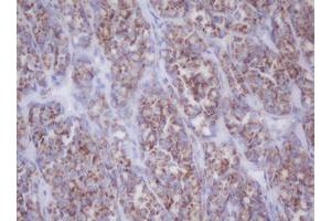 Image no. 1 for anti-Mitochondrial Translational Initiation Factor 3 (MTIF3) (AA 56-278) antibody (ABIN1491590) (MTIF3 抗体  (AA 56-278))