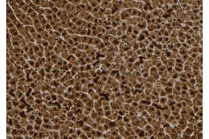 ABIN6272886 at 1/100 staining Rat liver tissue by IHC-P. (S100A14 抗体  (N-Term))