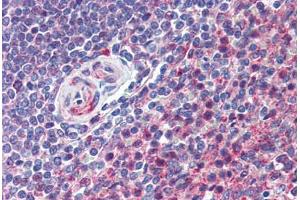 Human Spleen (formalin-fixed, paraffin-embedded) stained with CD97 antibody ABIN292888 at 10 ug/ml followed by biotinylated goat anti-rabbit IgG secondary antibody ABIN481713, alkaline phosphatase-streptavidin and chromogen. (CD97 抗体  (AA 220-270))