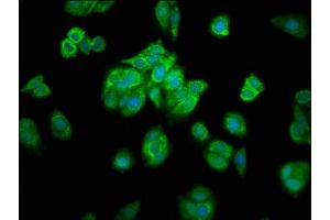 Immunofluorescence staining of HepG2 cells with ABIN7142357 at 1:200, counter-stained with DAPI.