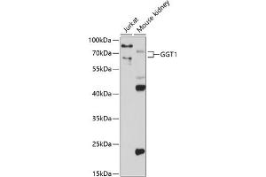 Western blot analysis of extracts of various cell lines, using GGT1 antibody (ABIN3022526, ABIN3022527, ABIN3022528 and ABIN6218881) at 1:1000 dilution. (GGT1 抗体  (AA 370-569))
