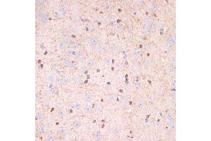 Immunohistochemistry of paraffin-embedded mouse brain using Gelsolin Rabbit mAb (ABIN7267364) at dilution of 1:100 (40x lens). (Gelsolin 抗体)