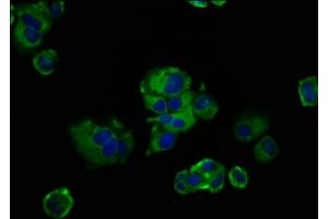 Immunofluorescence staining of MCF-7 cells with ABIN7153155 at 1:133, counter-stained with DAPI. (FREM2 抗体  (AA 1986-2127))