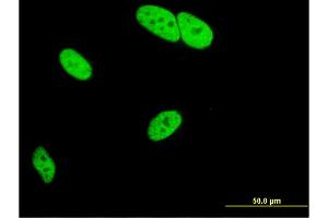 Immunofluorescence of monoclonal antibody to MED9 on HeLa cell. (MED9 抗体  (AA 1-146))